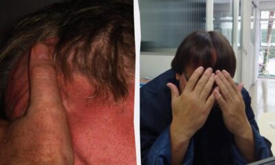 Split image: left—reddened sunburned neck/ear; right—a person hiding their face with hands outdoors indoors.