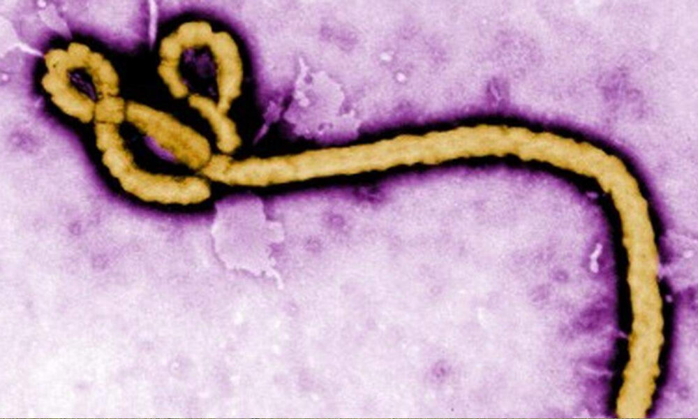 Color-enhanced electron micrograph of a bacteriophage with a rounded head and long curved tail against a purple background, illustrating a virus that infects bacteria.