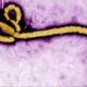 Color-enhanced electron micrograph of a bacteriophage with a rounded head and long curved tail against a purple background, illustrating a virus that infects bacteria.