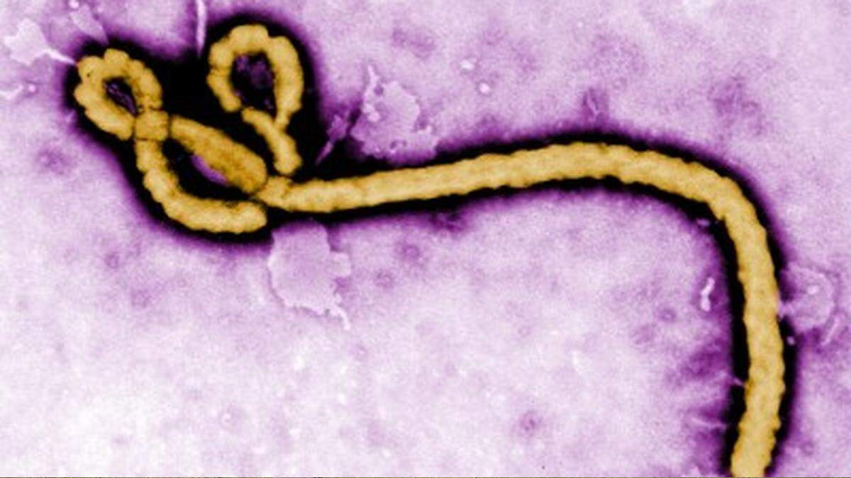 Color-enhanced electron micrograph of a bacteriophage with a rounded head and long curved tail against a purple background, illustrating a virus that infects bacteria.
