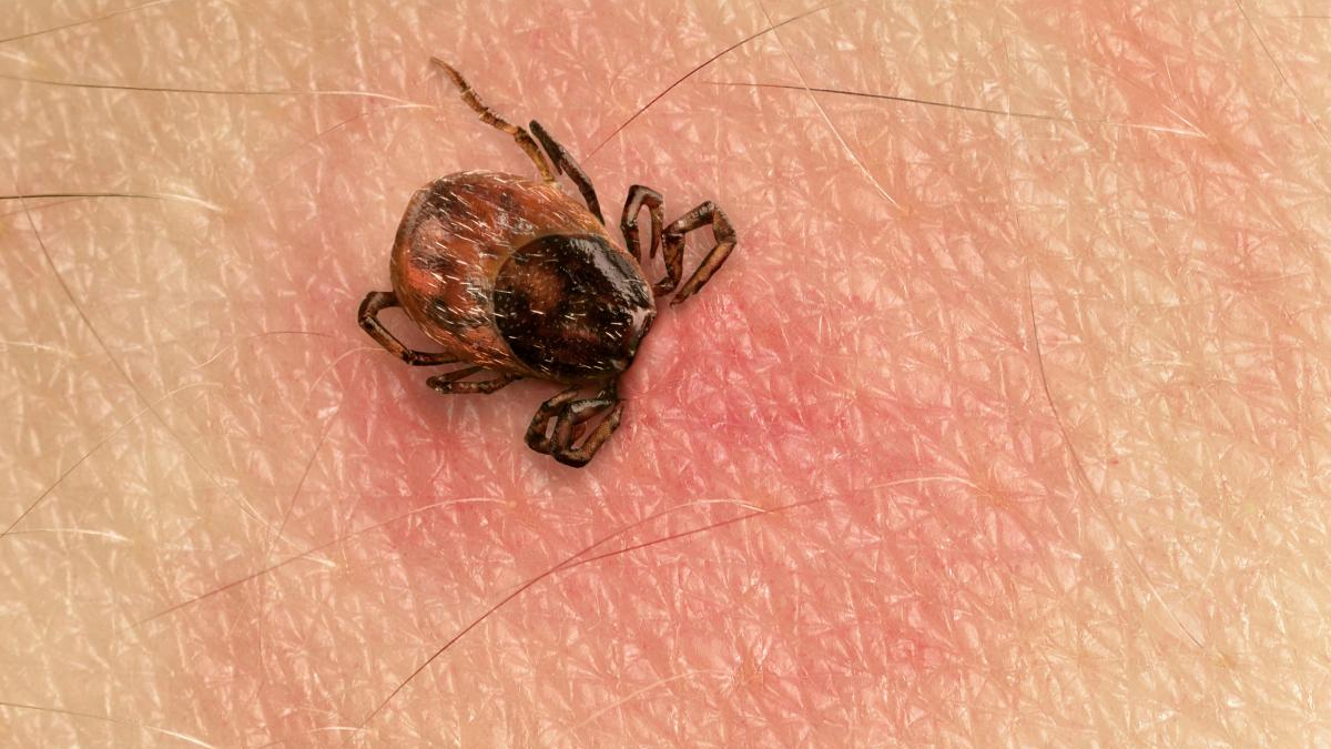 Close-up of a small brown tick attached to human skin on the arm/hand area.