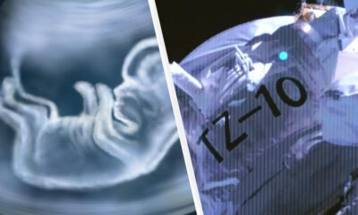Split-scene collage: left shows a blue-toned ultrasound of a fetal hand, right shows a spacecraft exterior with 'Z-10' marking and panel lines.