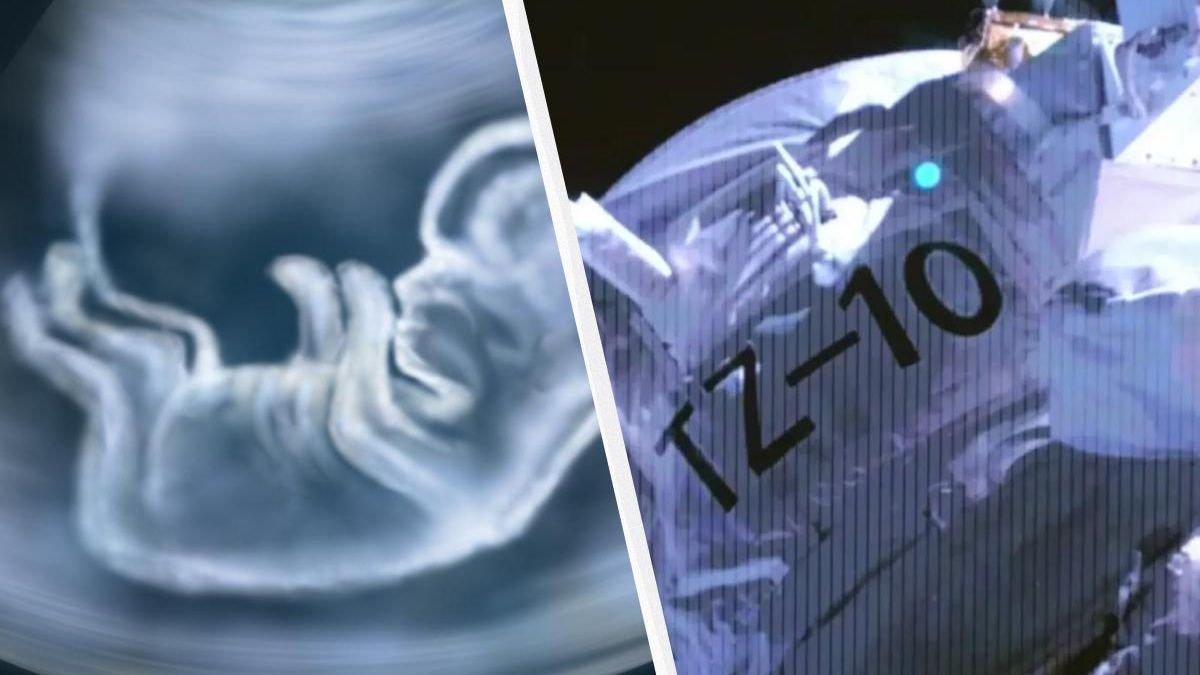 Split-scene collage: left shows a blue-toned ultrasound of a fetal hand, right shows a spacecraft exterior with 'Z-10' marking and panel lines.