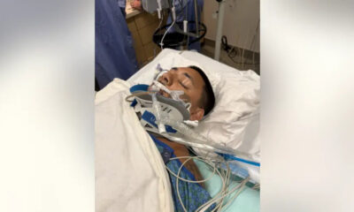 Patient lying in a hospital bed, intubated with a breathing tube and numerous medical tubes and wires nearby.