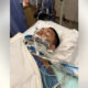 Patient lying in a hospital bed, intubated with a breathing tube and numerous medical tubes and wires nearby.