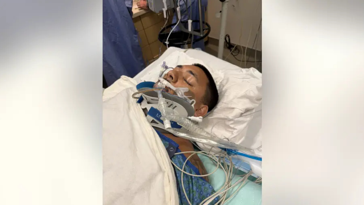 Patient lying in a hospital bed, intubated with a breathing tube and numerous medical tubes and wires nearby.