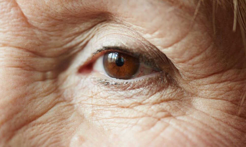 Close-up of a brown eye with prominent wrinkles around the eyelid and skin texture evident.