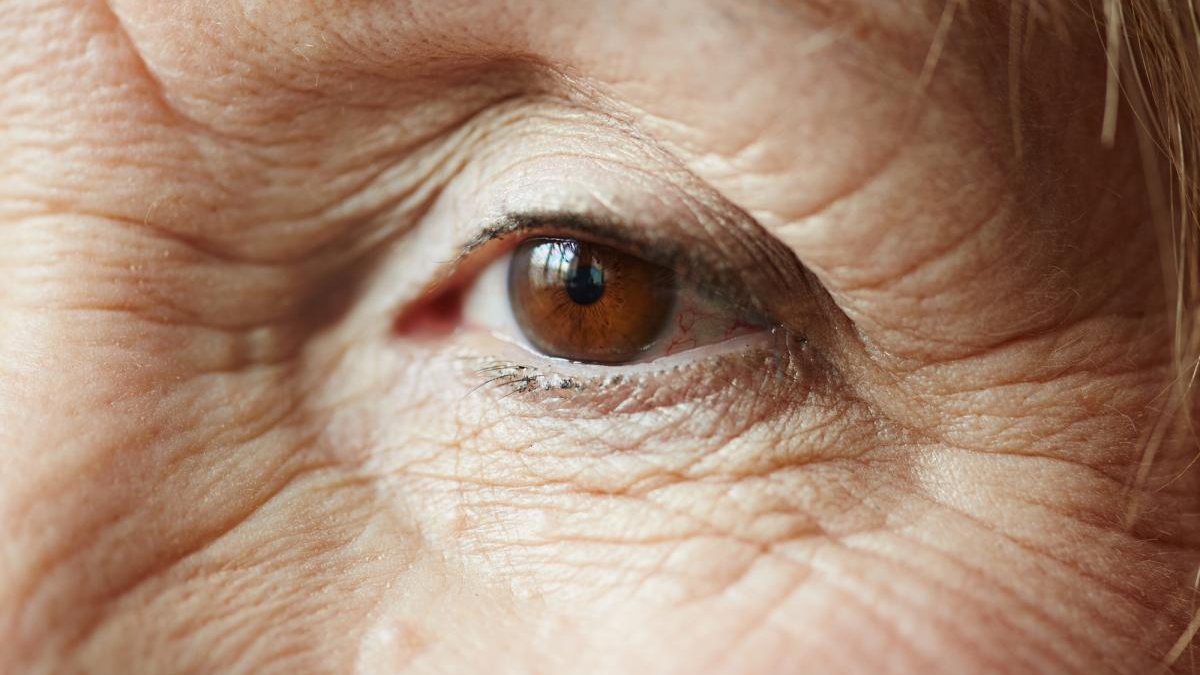 Close-up of a brown eye with prominent wrinkles around the eyelid and skin texture evident.