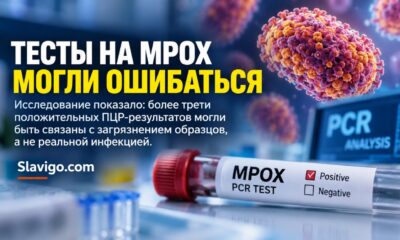Более трети положительных тестов на mpox в Конго могли быть ложными из-за загрязнения