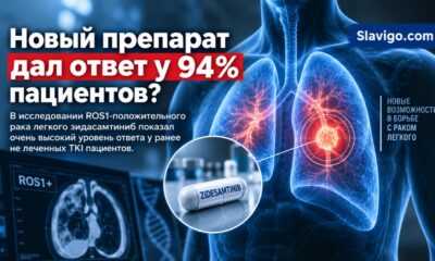 Зидесамтиниб дал ответ у 94% пациентов с ROS1-положительным раком лёгкого в раннем исследовании