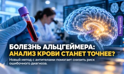 Анализ крови на болезнь Альцгеймера предложили уточнять с помощью специального антитела
