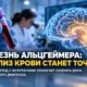 Анализ крови на болезнь Альцгеймера предложили уточнять с помощью специального антитела