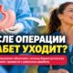Операция против ожирения и диабет: ремиссию за годы наблюдения получили 58% пациентов