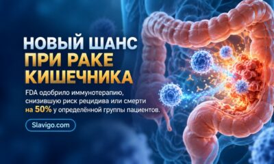 FDA одобрило добавление атезолизумаба к химиотерапии при части рака толстой кишки III стадии