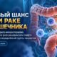 FDA одобрило добавление атезолизумаба к химиотерапии при части рака толстой кишки III стадии