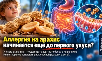 До первого контакта с арахисом: у детей с аллергией нашли возможный дефект защиты кишечника