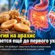 До первого контакта с арахисом: у детей с аллергией нашли возможный дефект защиты кишечника